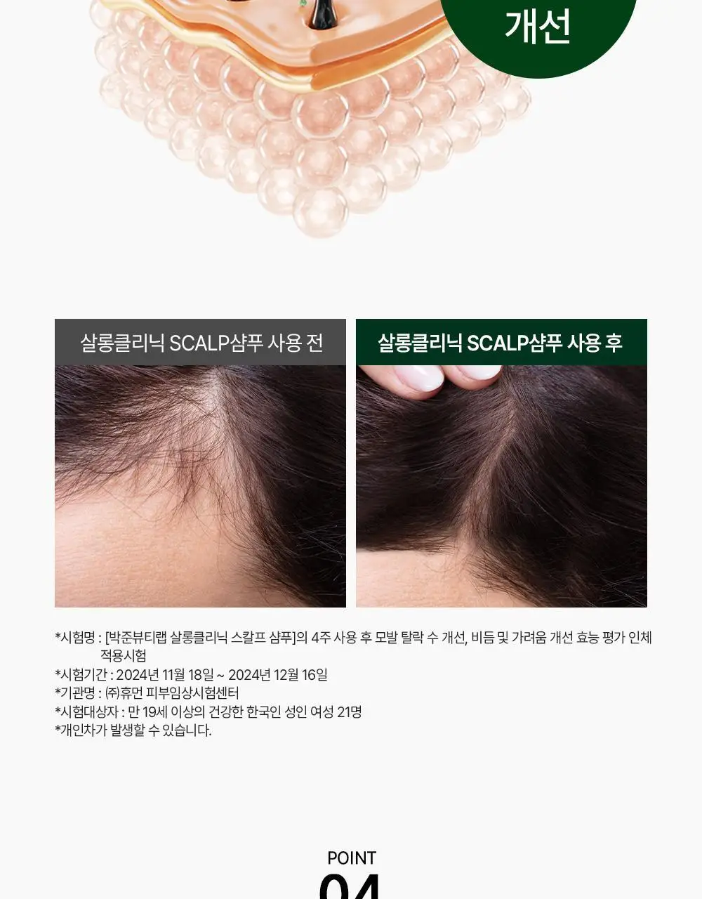 [각질/가려움] 박준뷰티랩 두피 클리닉 정수리 샴푸 500+200ml 두피샴푸 증정기획 상세페이지 18
